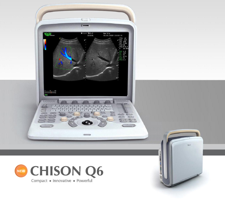 ecógrafo chison q6
